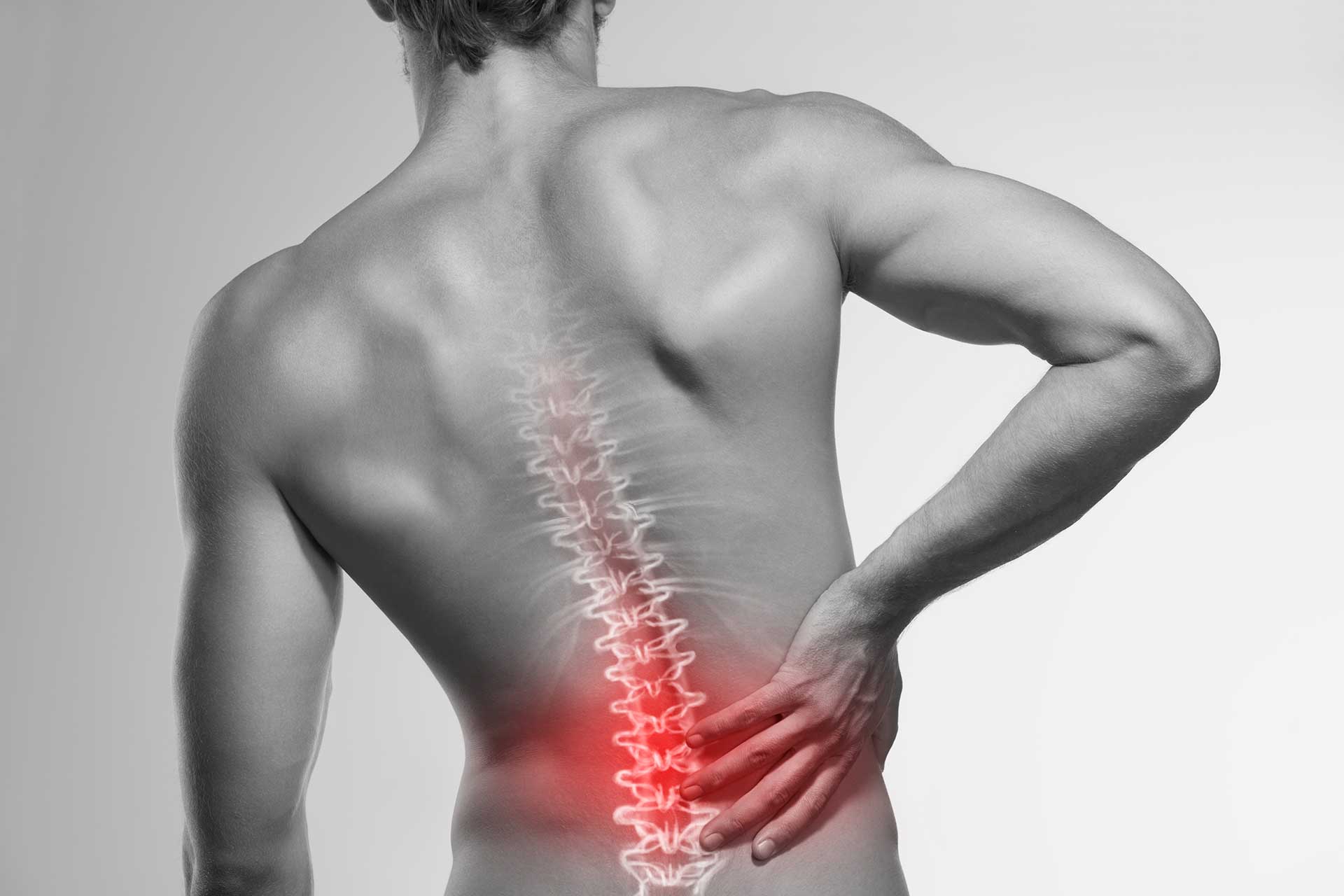 Bulging and Herniated Discs